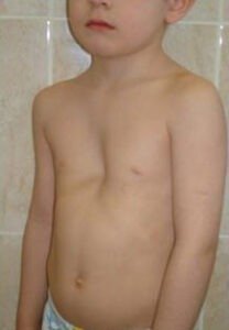 5752